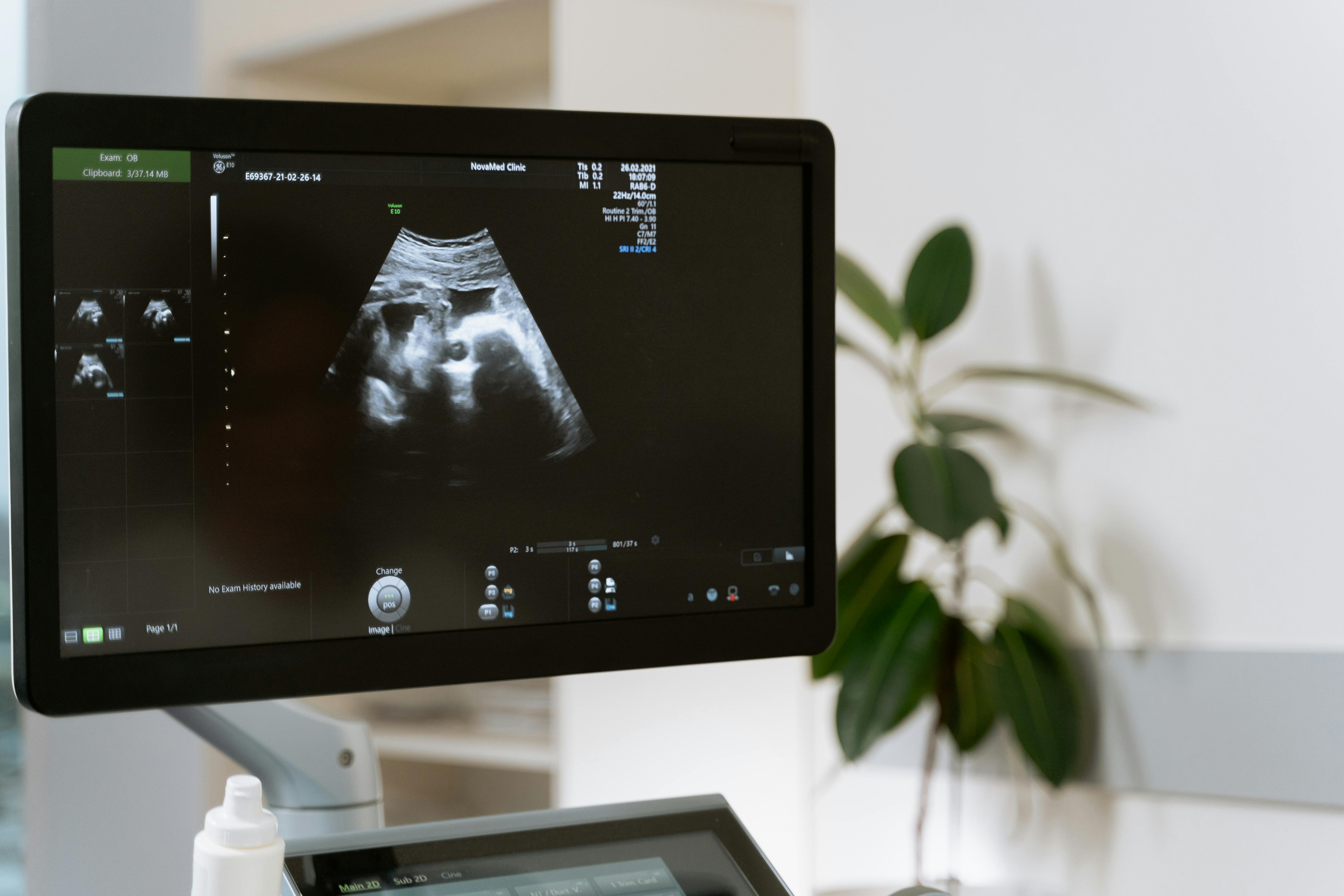 Gynaecology ultrasound consultation